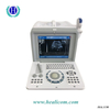 Medical Equipment HBW-2 ultrasonic portable mode ultrasound scanner