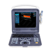 HUC-260 Portable Color Doppler Ultrasound Scanner 