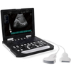 HBW-8 Laptop B/W Ultrasound Scanner