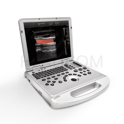 HUC-300P Full Digital Laptop Color Doppler Ultrasound Machine 