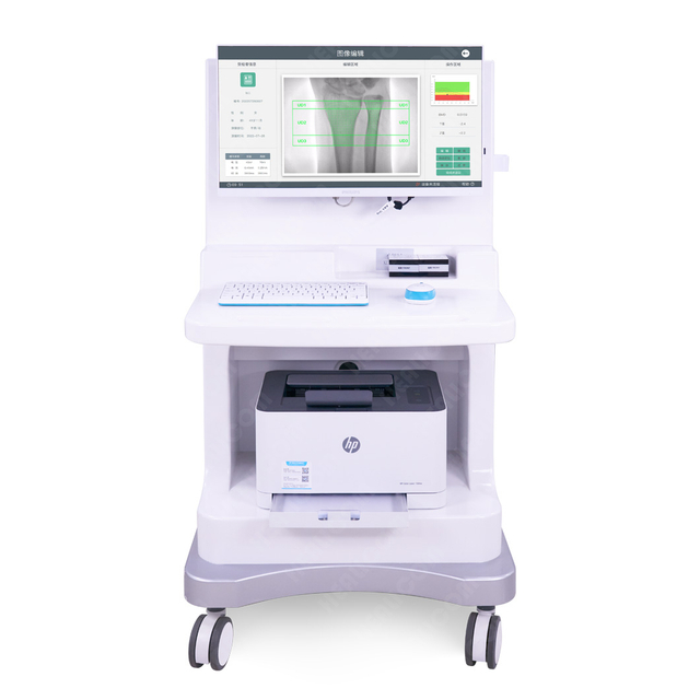 HDX8000 Mobile Dual Energy Bone X-ray Densitometer
