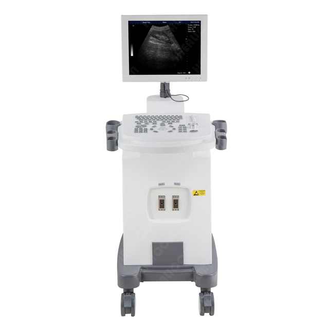 HBW-10 Plus Full Digital Trolley B/W Ultrasound Scanner
