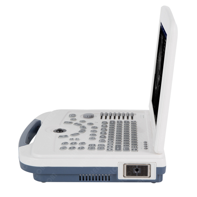 HBW-4 Full Digital Laptop B/W Ultrasound Scanner