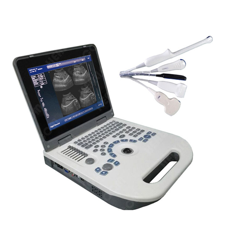 HBW-3P Full Digital Portable B/W Ultrasound Scanner