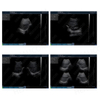 HBW-4P Hospital 12.1 Inch LCD Displayer B/W Ultrasound Scanner