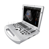 HUC-300P Full Digital Laptop Color Doppler Ultrasound Machine 