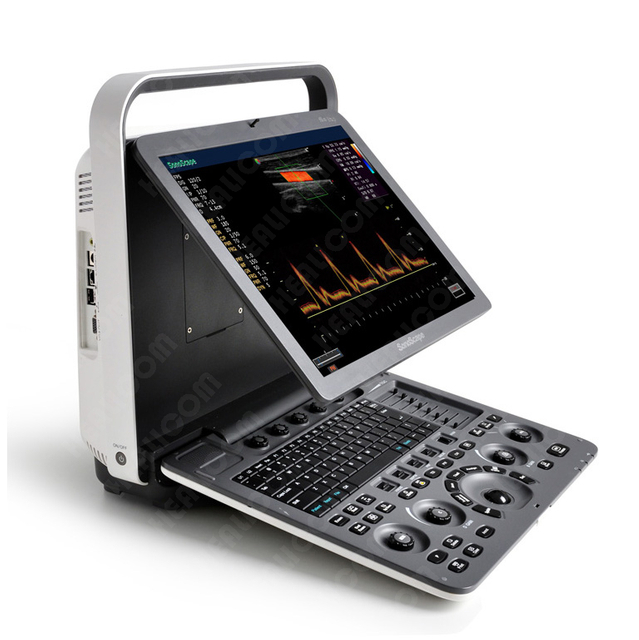 Sonoscape S8 Exp Potable 4D Color Doppler Ultrasound Machine