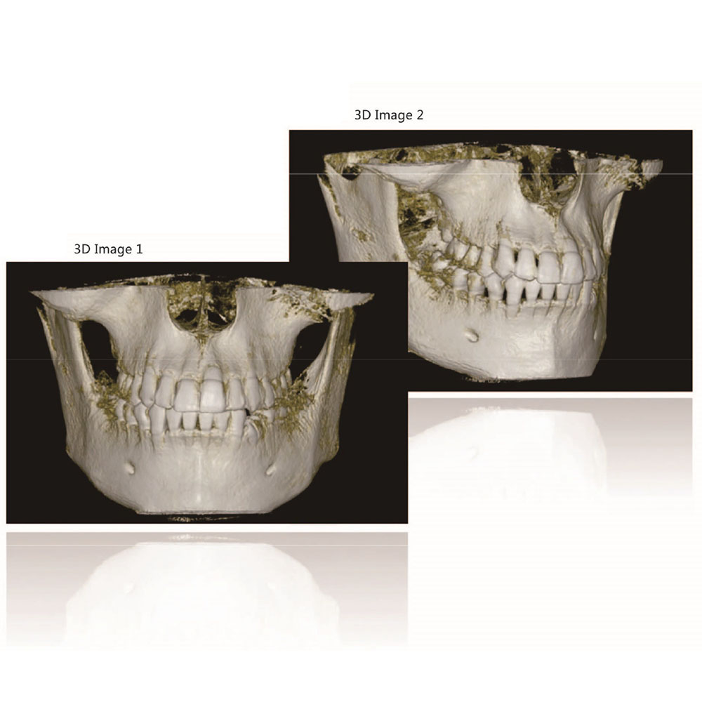 Dental Imaging