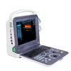HUC-260 Portable Color Doppler Ultrasound Scanner 