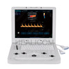 HUC-190 Hospital Portable Color Doppler Ultrasound System