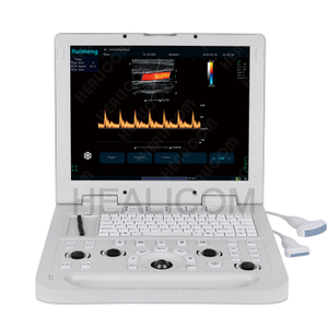 HUC-190 Hospital Portable Color Doppler Ultrasound System