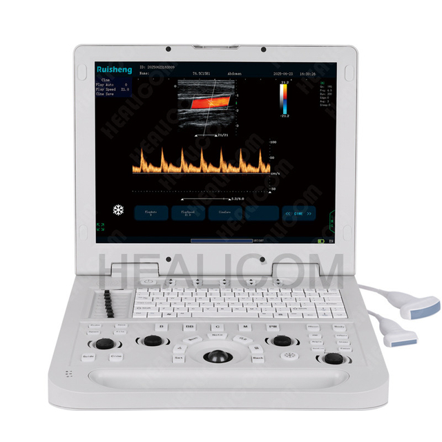 HUC-190 Hospital Portable Color Doppler Ultrasound System