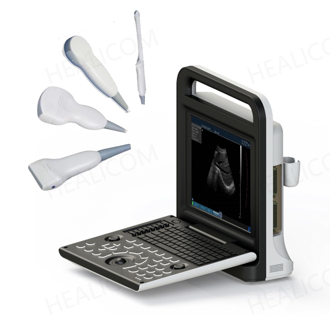 Ultrasound Machinr1