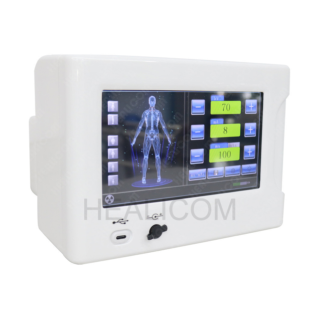 HFX-02D High Resolution Medical Radiography Portable Digital X Ray System