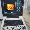 HBW-6P Full Digital Laptop B/W Ultrasound Scanner