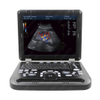 HUC-550/560/570 Laptop Color Doppler Ultrasound Scanner 