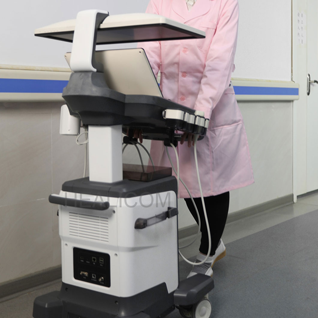 4D Color Doppler Ultrasound