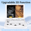 HUC-190 Hospital Portable Color Doppler Ultrasound System