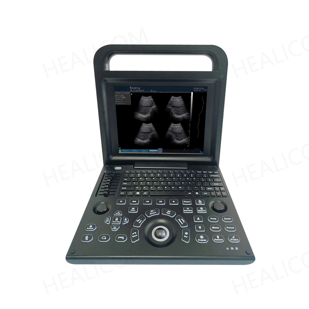 Ultrasound Machinr4