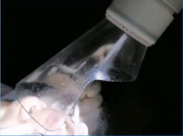 In Stock HS-E1000 Portable External Oral Suction Device