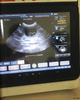 HV-50A Vet Touch B/W Portable Ultrasound Scanner diagnostic machine system