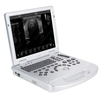 HUC-250 Laptop 4D Color Doppler Ultrasound Scanner 