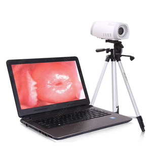 HKN-2100 Portable Digital Video Colposcope for Gynecology