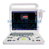 Medical Advanced Portable Ultrasound Scanner Diagnostic Instrument Ultrasound Machine