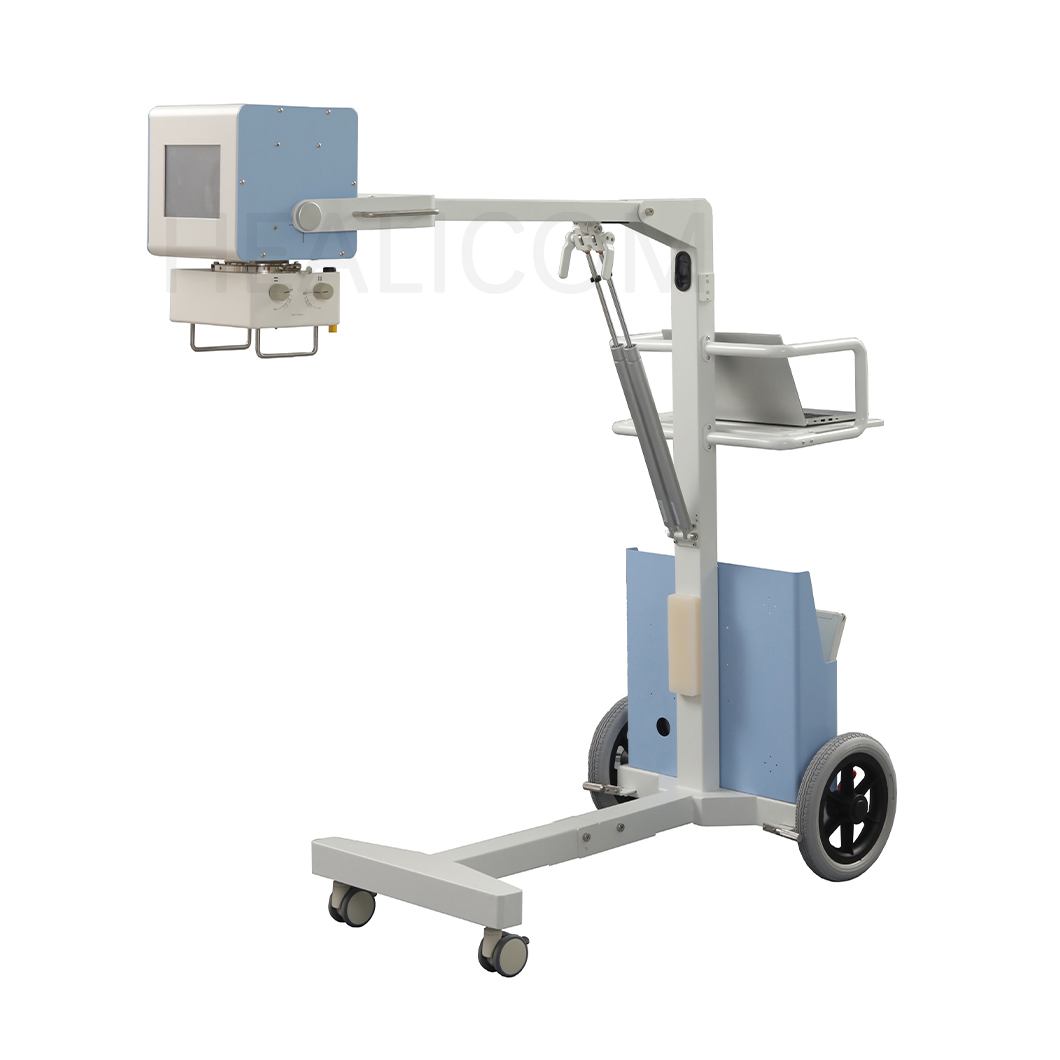 Digital Portable X-ray System (5)