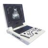 HBW-6P Full Digital Laptop B/W Ultrasound Scanner