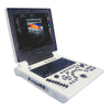 HUC-180 Laptop Color Doppler Ultrasound Scanner 