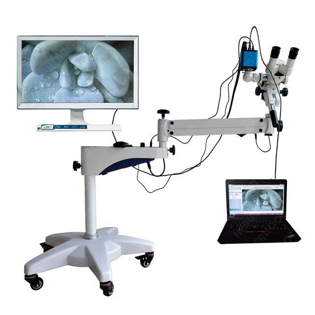 YDJ-II High Resolution Optical Colposcopy Vaginal Microscope