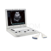 HBW-7 Medical Diagnostic System Portable Full Digital B/W Ultrasound Scanner