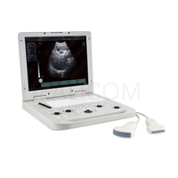 HBW-7 Medical Diagnostic System Portable Full Digital B/W Ultrasound Scanner