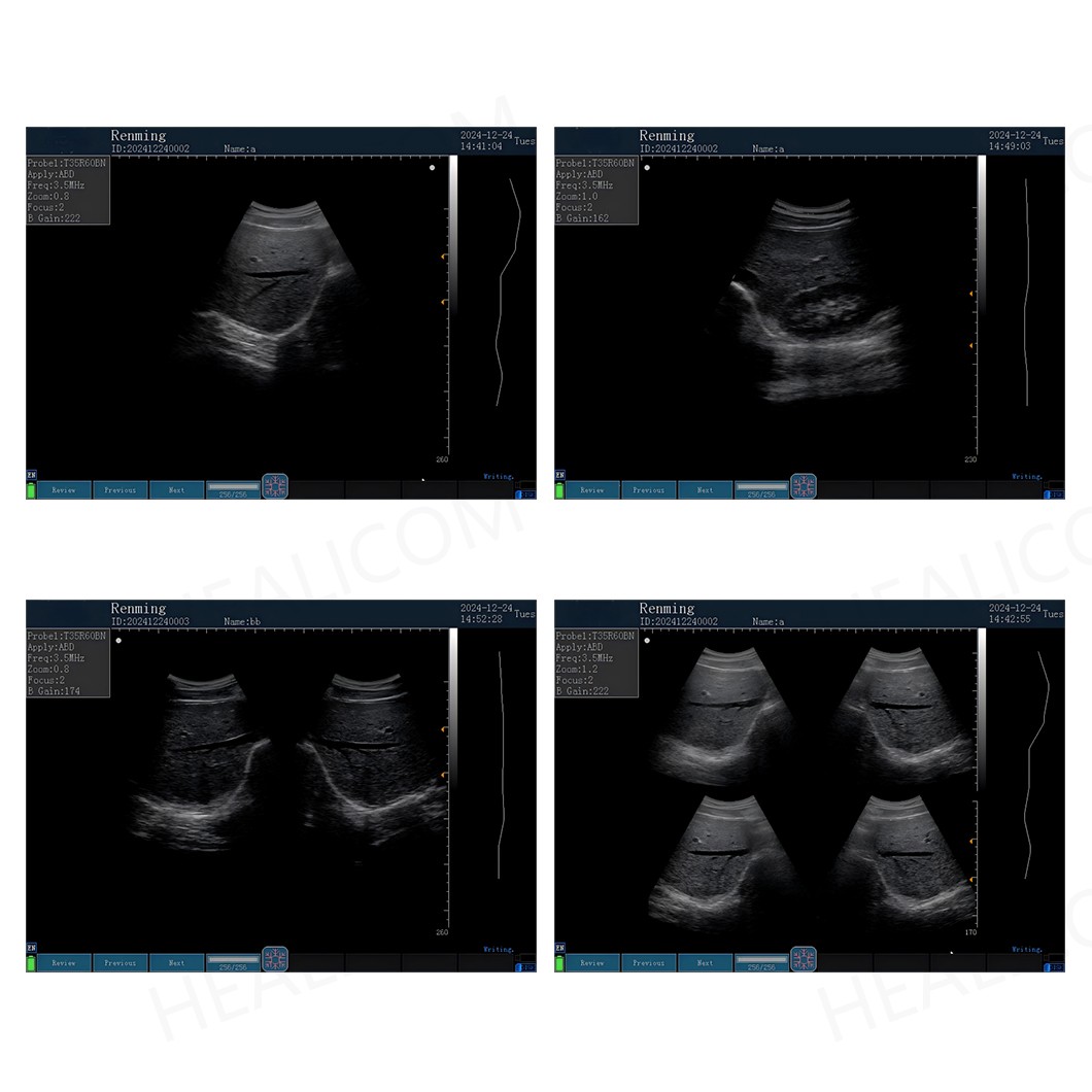 Ultrasound Machinr7
