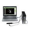 HO-200 Ophthalmic A/B ultrasound box scanner
