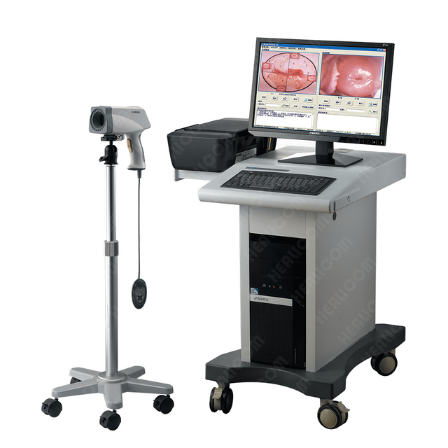 HKN-2300 High Resolution 2.5 Inch LCD Screen Trolley Digital Video Gynecology Colposcope