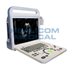 HUC-220 Laptop Color Doppler Ultrasonic Diagnostic Ultrasound Scanner 
