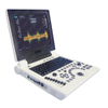 HBW-6P Full Digital Laptop B/W Ultrasound Scanner