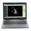 HO-200 Ophthalmic A/B ultrasound box scanner