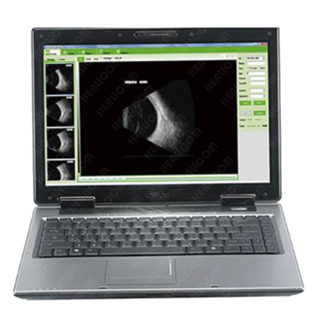 HO-200 Ophthalmic A/B ultrasound box scanner