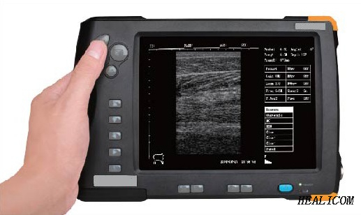 HV-5 Veterinary Medical Equipment Portable animal Handheld laptop B/W Vet Sonar system/Ultrasound Scanner