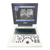 HBW-6 Full Digital Laptop B/W Ultrasound Scanner