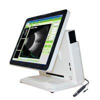 HO-500 Medical Full Digital Ophthalmic A B Ultrasound Scanner