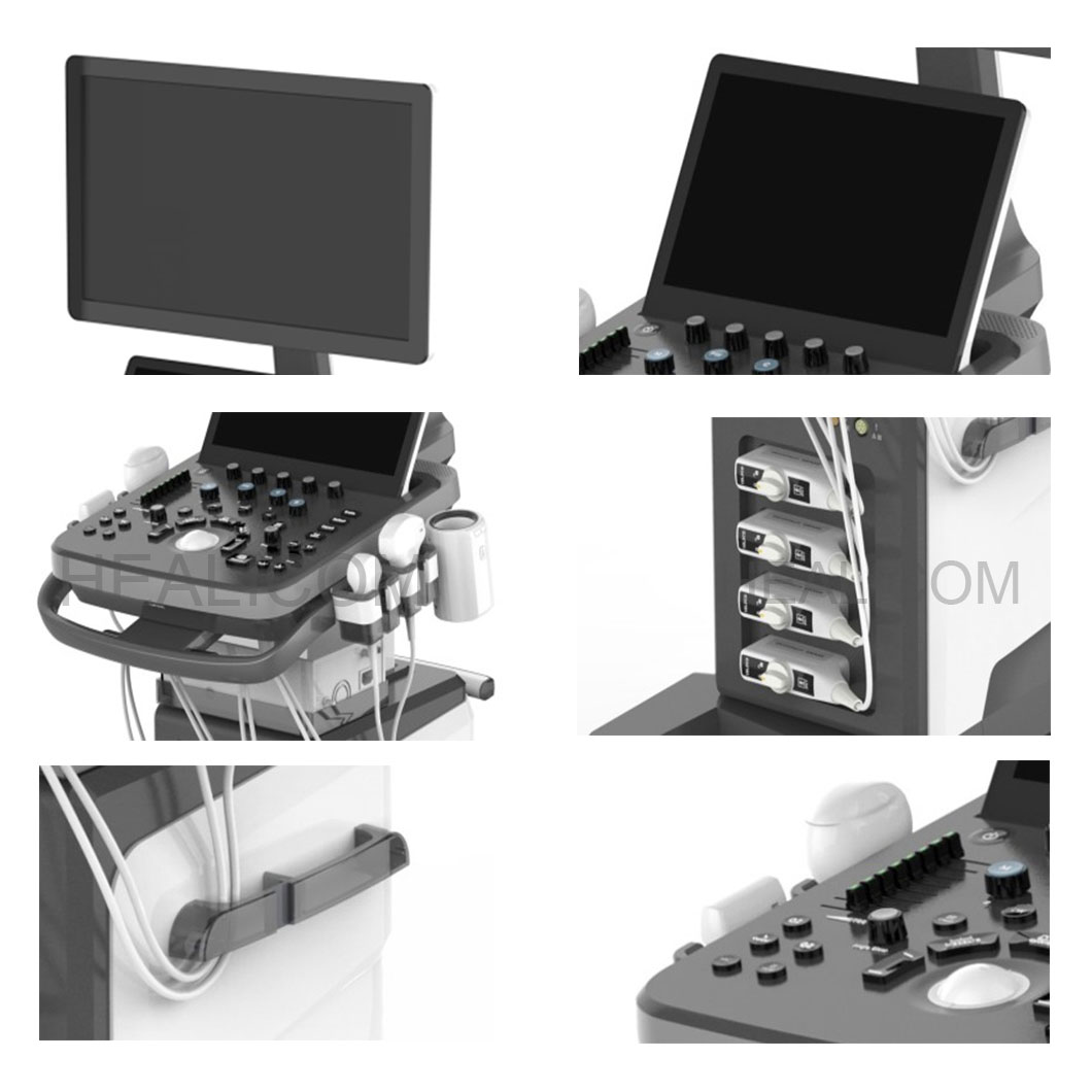 4D Color Doppler Ultrasound Scanner