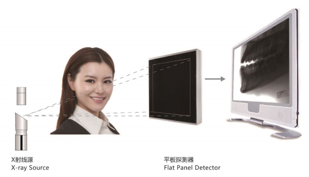 H-X9010dpro-2D-Digital-Panoramic-Dental-X-ray-Machine (3)