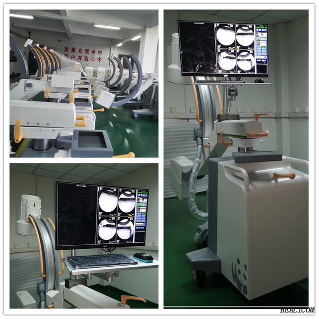 HCA-20C Factory Price Medical Hospital High Frequency Mobile Digital C Ram X-ray Machine C-Arm Radiography Imaging System